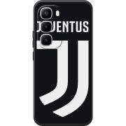 Чохол BoxFace Infinix Hot 60 Pro Plus FC J