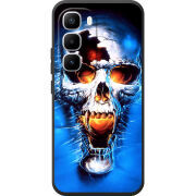 Чохол BoxFace Infinix Hot 60 Pro Plus 