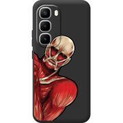 Чорний чохол BoxFace Infinix Hot 60 Pro Plus Титан