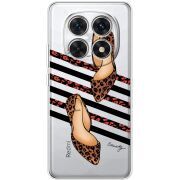 Прозорий чохол BoxFace Poco M8 Love Beauty