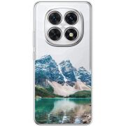 Прозорий чохол BoxFace Poco M8 Blue Mountain