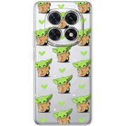 Прозорий чохол BoxFace Poco M8 Pattern Baby Yoda