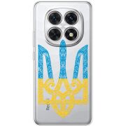 Прозорий чохол BoxFace Poco M8 Gold Trident