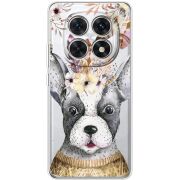 Прозорий чохол BoxFace Poco M8 