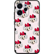 Чохол BoxFace OPPO Reno 15 F 