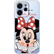 Прозорий чохол BoxFace OPPO Reno 15 F Lady M