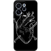 Чохол BoxFace OPPO Reno 15 FS 