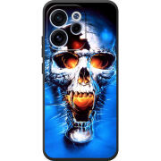 Чохол BoxFace OPPO Reno 15 FS 