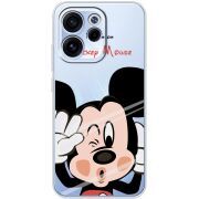 Прозорий чохол BoxFace OPPO Reno 15 FS Mister M