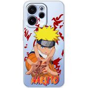 Прозорий чохол BoxFace OPPO Reno 15 FS Naruto