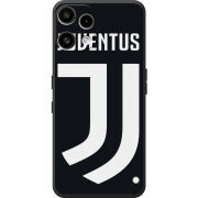 Чохол BoxFace Nothing Phone (3a) Lite FC J