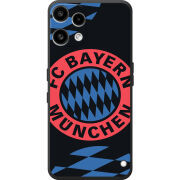 Чохол BoxFace Nothing Phone (3a) Lite FC Bayern