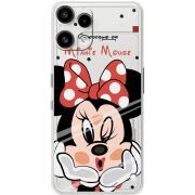 Прозорий чохол BoxFace Nothing Phone (3a) Lite Lady M