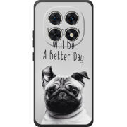 Чохол BoxFace Xiaomi Redmi Note 15 4G 