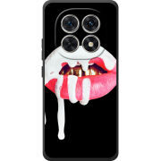 Чохол BoxFace Xiaomi Redmi Note 15 4G 