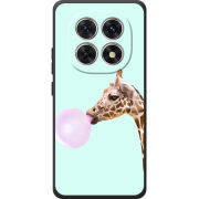 Чохол BoxFace Xiaomi Redmi Note 15 4G 