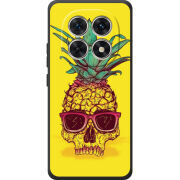 Чохол BoxFace Xiaomi Redmi Note 15 4G Pineapple Skull