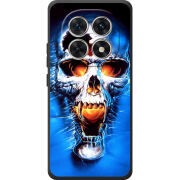 Чохол BoxFace Xiaomi Redmi Note 15 4G 