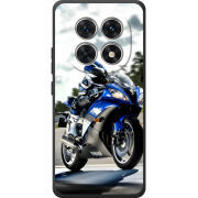 Чохол BoxFace Xiaomi Redmi Note 15 4G 