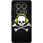 Чохол BoxFace Xiaomi Redmi Note 15 4G 