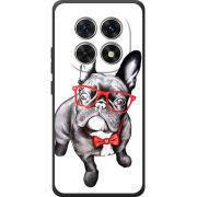 Чохол BoxFace Xiaomi Redmi Note 15 4G 