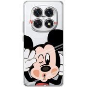 Прозорий чохол BoxFace Xiaomi Redmi Note 15 4G Mister M