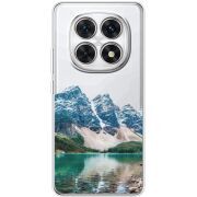 Прозорий чохол BoxFace Xiaomi Redmi Note 15 4G Blue Mountain