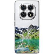 Прозорий чохол BoxFace Xiaomi Redmi Note 15 4G Green Mountain