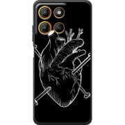 Чохол BoxFace Motorola G17 