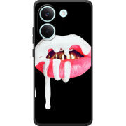 Чохол BoxFace Poco X8 Pro 