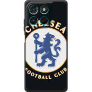 Чохол BoxFace Moto G77 FC Chelsea