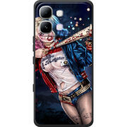 Чохол BoxFace Infinix Note Edge Harley Quinn