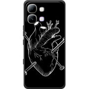 Чохол BoxFace Infinix Note Edge 
