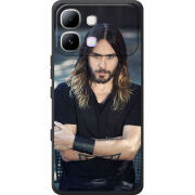 Чохол BoxFace Infinix Note Edge 
