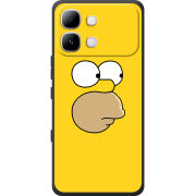Чохол BoxFace Infinix Note Edge 