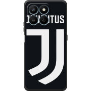 Чохол BoxFace Honor 400 Smart FC J