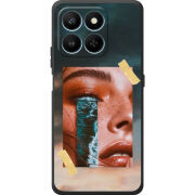 Чохол BoxFace Honor 400 Smart 