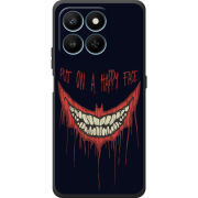 Чохол BoxFace Honor 400 Smart 
