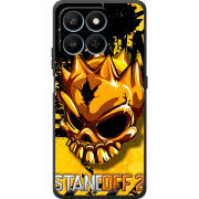 Чохол BoxFace Honor 400 Smart StandOff 2 gold