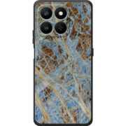 Чохол BoxFace Honor 400 Smart 