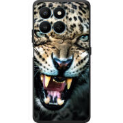 Чохол BoxFace Honor 400 Smart 