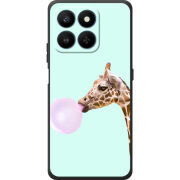Чохол BoxFace Honor 400 Smart 
