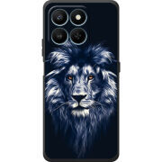 Чохол BoxFace Honor 400 Smart 