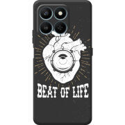 Чохол BoxFace Honor 400 Smart 