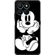 Чохол BoxFace Honor 400 Smart 