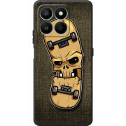 Чохол BoxFace Honor 400 Smart 