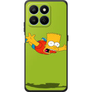 Чохол BoxFace Honor 400 Smart 