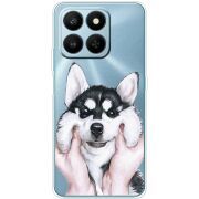 Прозорий чохол BoxFace Honor 400 Smart Husky