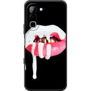 Чохол BoxFace Infinix Hot 70 