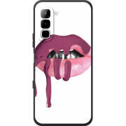 Чохол BoxFace Infinix Hot 70 